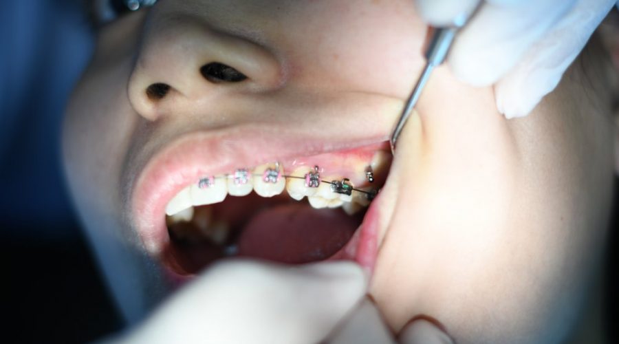 Tandläkare i Sollentuna som kan åtgärda olika sorters tandbesvär