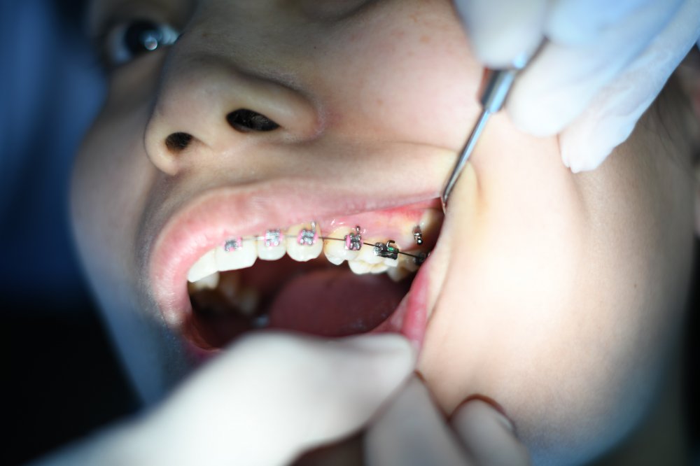 Tandläkare i Sollentuna som kan åtgärda olika sorters tandbesvär